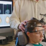 Brain Stimulation Therapy